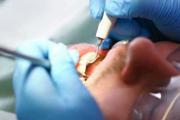 Best Weekend Emergency Dentist in Hyattsville, MD