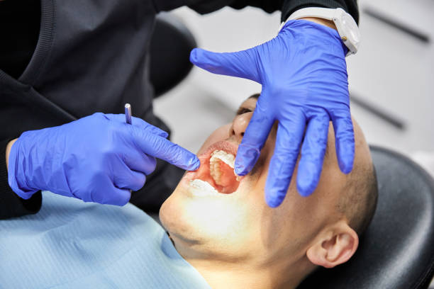 Best Emergency Dental Care for Trauma or Injury in Hyattsville, MD