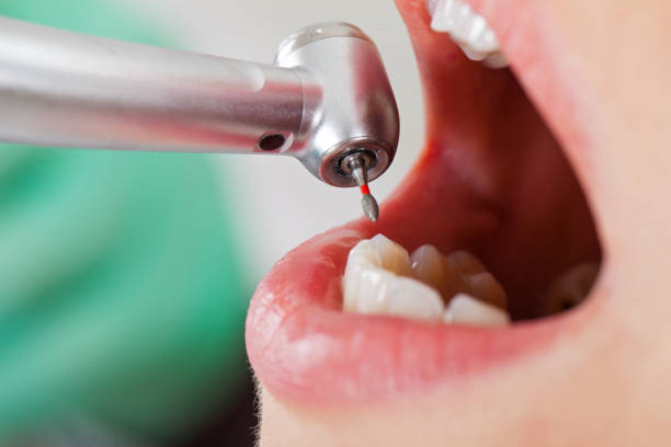 Best Emergency Treatment for Toothache in Hyattsville, MD